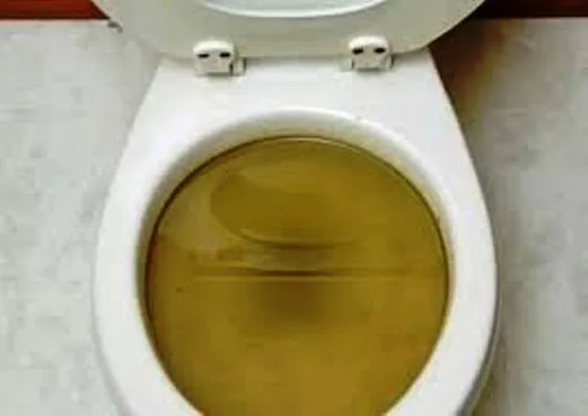 Slide of A-1 Destupiciones