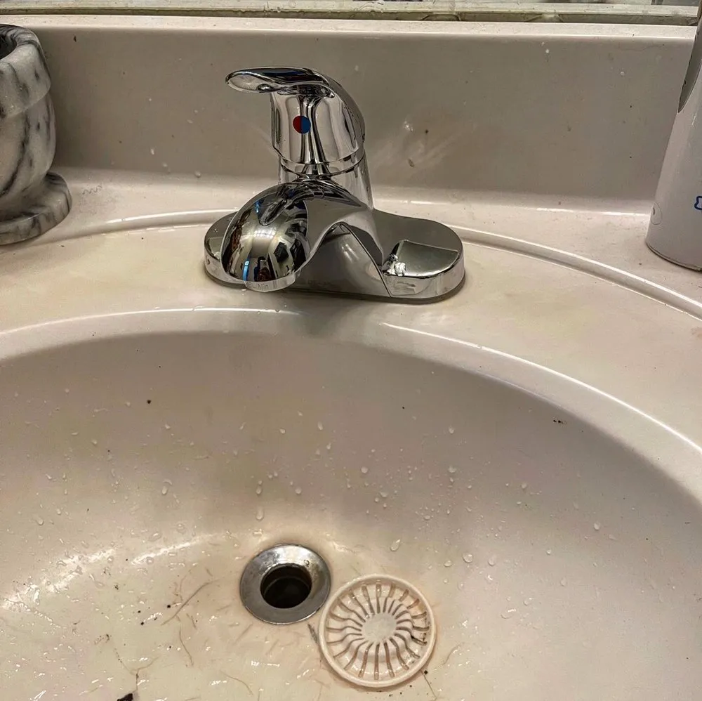 Slide of Alkaline Backflow