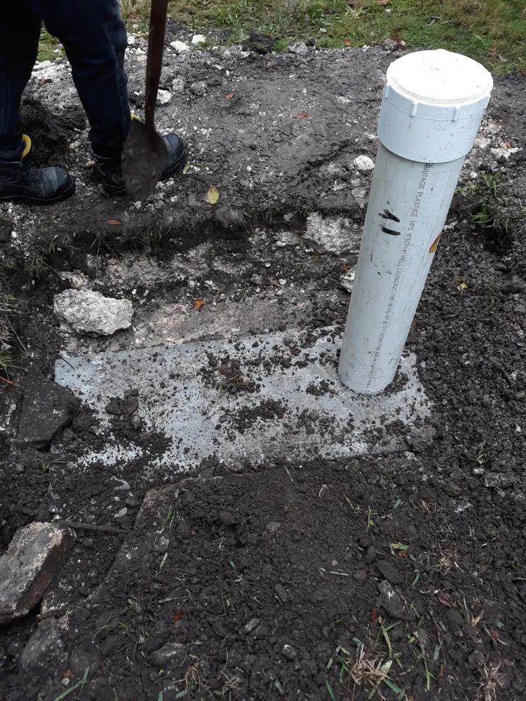 Slide of EUS International Septic