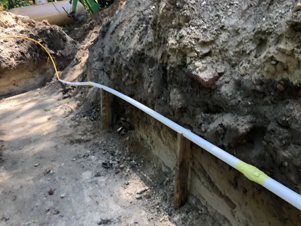 Slide of Mr. B's P&H