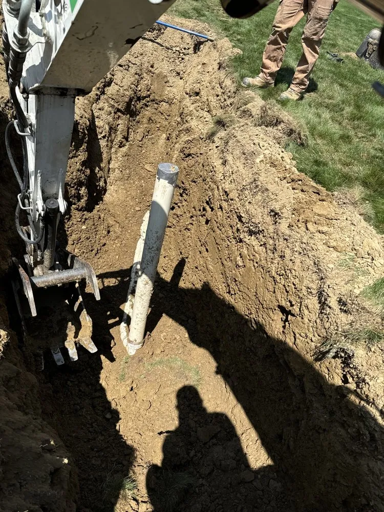 Slide of Pfeuffer Contracting