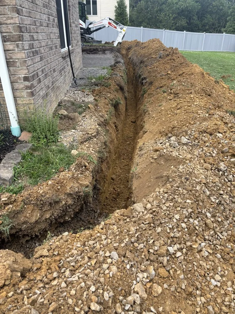 Slide of Pfeuffer Contracting