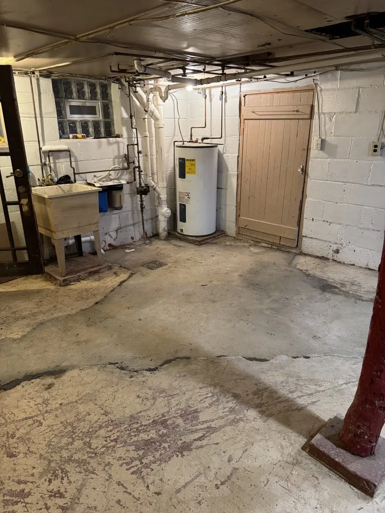 Slide of Pfeuffer Contracting