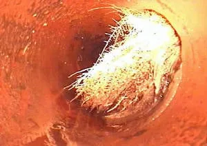 Slide of Precision Locating