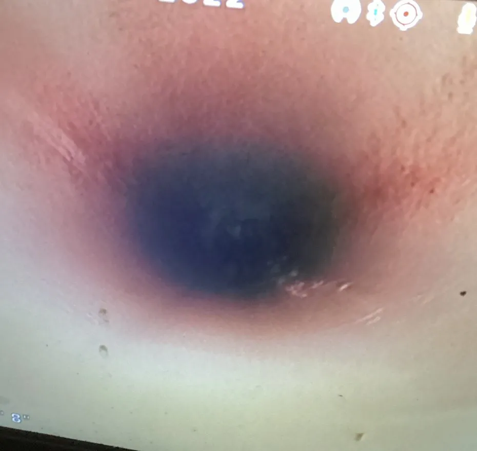 Slide of Smart Drain Solutions