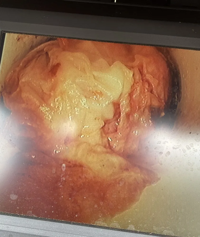 Slide of Smart Drain Solutions