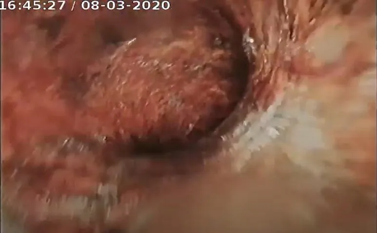 Slide of Zippity Split